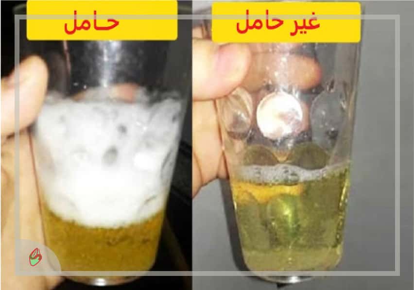شكل البول بعد اختبار الحمل بالملح - صحة حياة