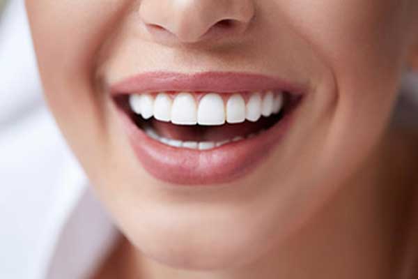 اسعار تجميل الاسنان في تركيا و أفضل عيادة أسنان في اسطنبول