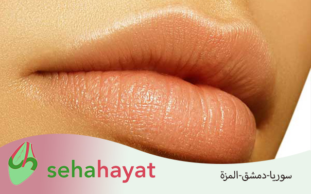 تجميل الشفايف في سوريا