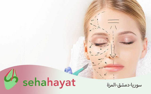 فيلر في سوريا 2025