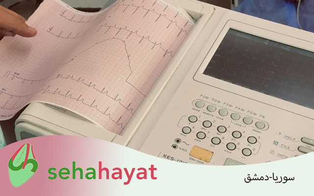 ما هو تخطيط القلب الكهربائي (ECG) 2026